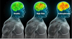 Integrating Motivational Interviewing Techniques to Overcome Barriers to the Use of Long-Acting Injectable Agents in Patients with Schizophrenia